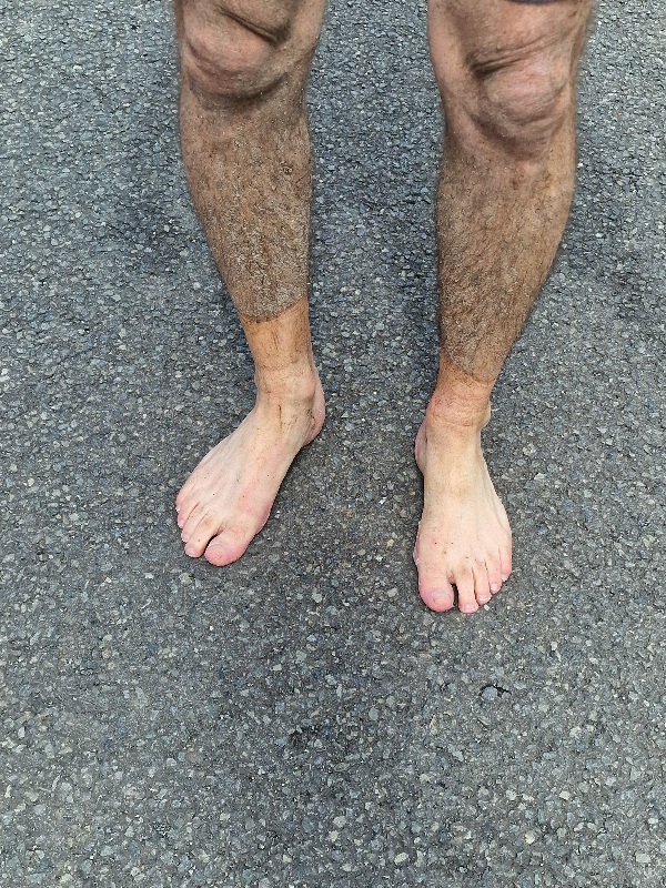 Le bronzage de Christophe.C